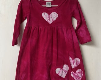 Pink Baby Dress, Valentine's Day Baby Dress, First Valentine's Day, Pink Heart Dress, Heart Baby Dress, Baby Heart Dress (12 months) SALE