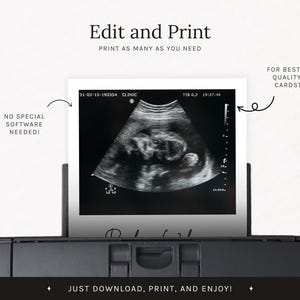 May include: A black and white ultrasound image of a fetus is displayed on a white card. The card is in a printer. Text on the image says "Edit and Print" and "Just download, print, and enjoy!"