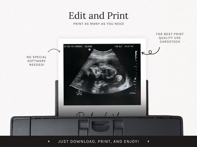 May include: A black and white ultrasound image of a fetus is displayed on a white card. The card is in a printer. Text on the image says "Edit and Print" and "Just download, print, and enjoy!"