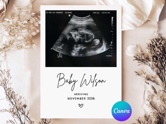 Ultrasound Photo Pregnancy Announcement Card Template, We’re Expecting Card Printable, Baby Reveal Announcement Card, 5x7, Editable in Canva
