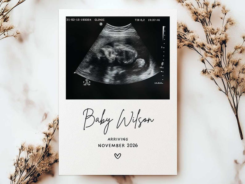 May include: A pregnancy announcement card with a sonogram image at the top. The text "Baby Wilson" is written in elegant script, with "Arriving November 2026" below, and a heart symbol at the bottom. The card is on a neutral background.