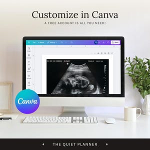 May include: A computer monitor displays an ultrasound image of a fetus. The screen shows the text "Customize in Canva" and "A FREE ACCOUNT IS ALL YOU NEED!" A keyboard, mouse, and coffee cup are on the white desk.