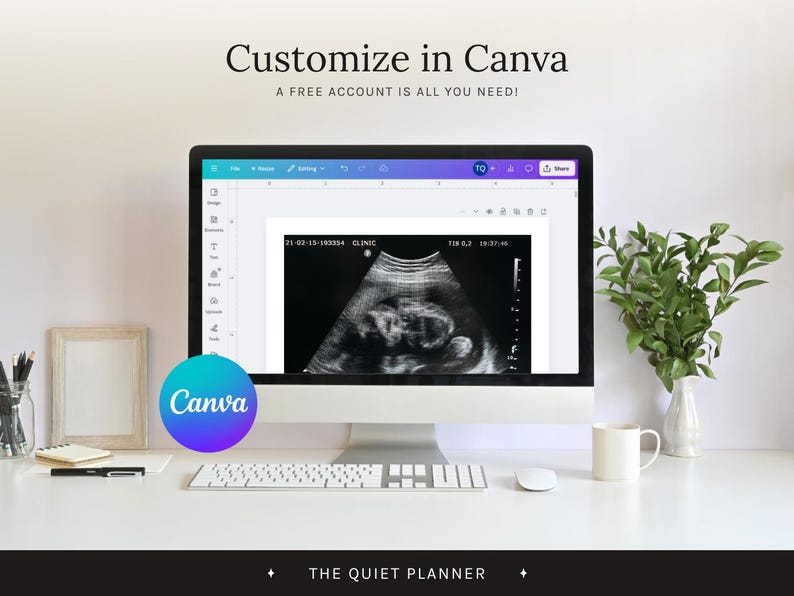 May include: A computer monitor displays an ultrasound image of a fetus. The screen shows the text "Customize in Canva" and "A FREE ACCOUNT IS ALL YOU NEED!" A keyboard, mouse, and coffee cup are on the white desk.