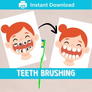 Könnte beinhalten: Illustration zum Zähneputzen. Zwei Bilder eines Cartoon-Kindes mit roten Haaren und einer grünen Zahnbürste. Ein Bild zeigt schmutzige Zähne, das andere saubere Zähne. Die Wörter "Sofort-Download" und "TEETH BRUSHING" sind ebenfalls sichtbar.