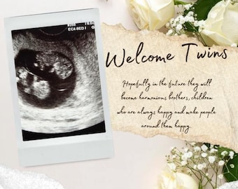 Puede incluir: Imagen de ultrasonido de gemelos en un marco polaroid, con el texto "Welcome Twins". La imagen está rodeada de rosas blancas y paniculata, con un mensaje sobre el futuro de los gemelos.
