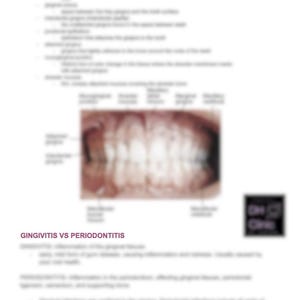 Tabelas de descrição de higiene dental gengival Folha de referência