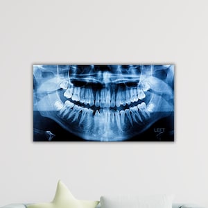 Póster de radiografía dental, lienzo de radiografía dental, decoración de pared para sala de dentistas, decoración de pared para consultorio dental, impresión de radiografía dental, arte de pared de radiografía dental