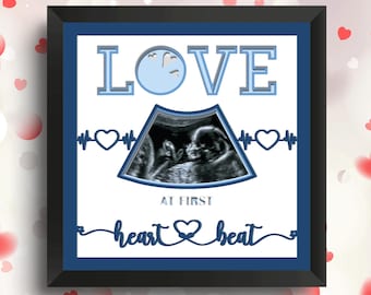 Baby Ultrasound Shadow Box SVG File for Cricut Projects, Ultrasound Display, Baby Shower Decor Gift for Mom, Pregnancy Announcement, 3D SVG