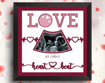 Baby Ultrasound Shadow Box SVG File for Cricut Projects, Ultrasound Display, Baby Shower Decor Gift for Mom, Pregnancy Announcement, 3D SVG