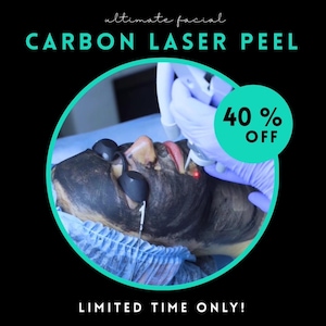 May include: A person receiving a carbon laser peel facial treatment. The person's face is covered in a black mask and a laser device is being used on their face. The image includes the text "ultimate facial CARBON LASER PEEL" and "40% OFF".