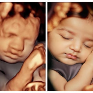 Ultrasound transformation, ultrasound baby, first baby photo, 3d 4d 5d ultrasound, real view, baby image, baby shower gift, unborn baby