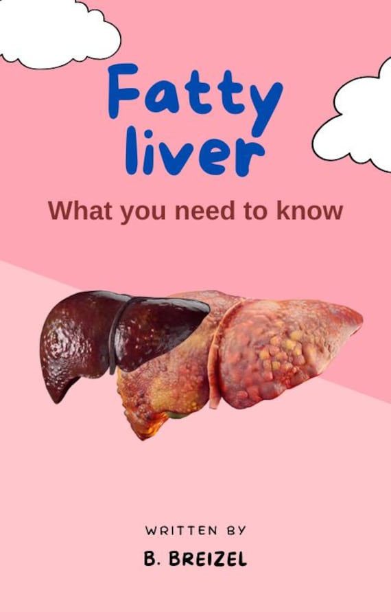 Fatty Liver Diet & Detox Guide: NAFLD/NASH Natural Treatment (PDF Downloadable eBook)