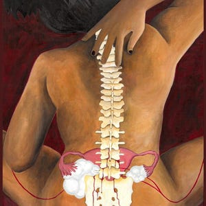 May include: An artistic painting depicting a human back with a visible spine and pelvic bone structure. The illustration features a pink uterus with white, cloud-like masses attached to the ovaries, set against a deep red background.