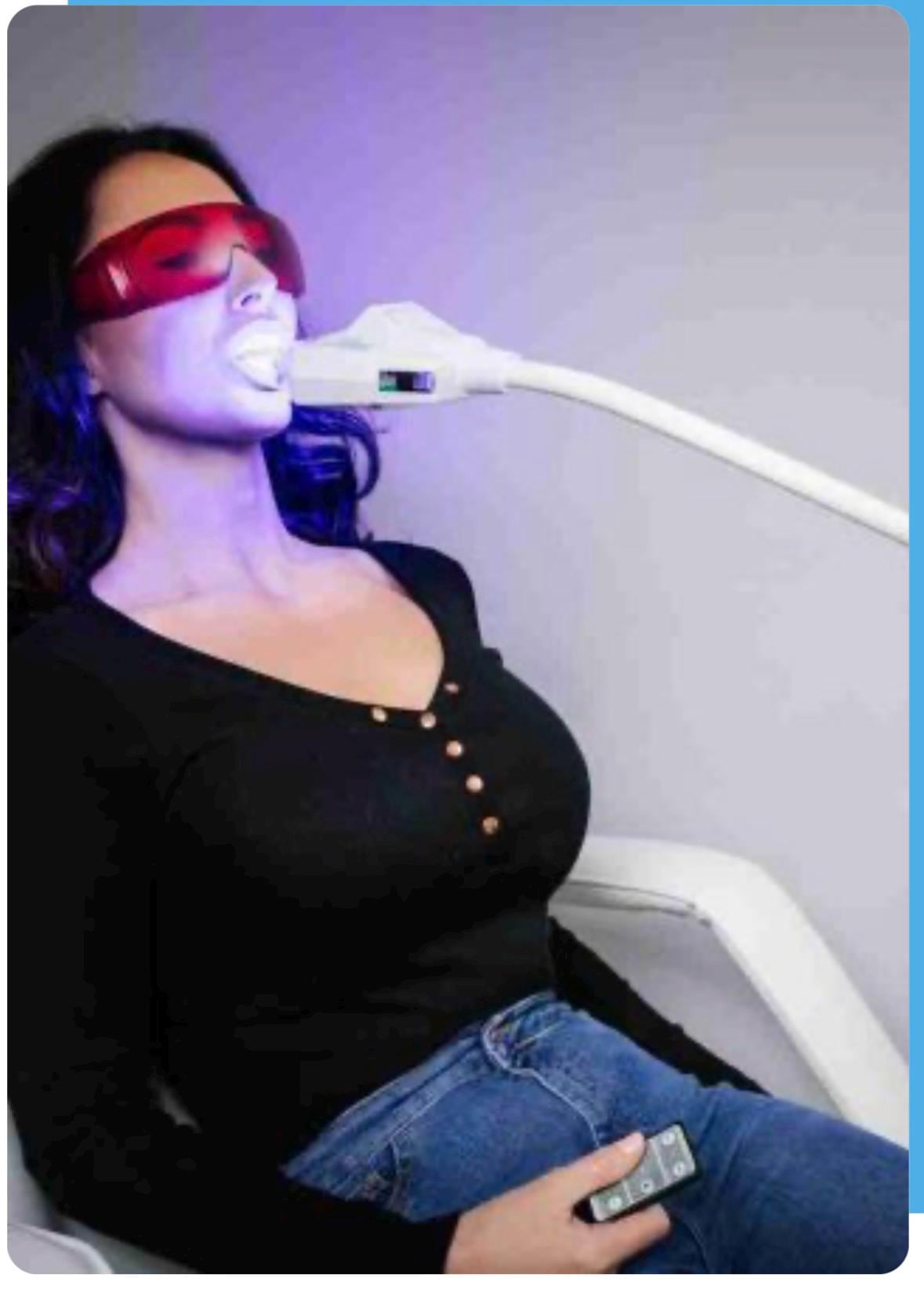 Blanchiment des dents au laser