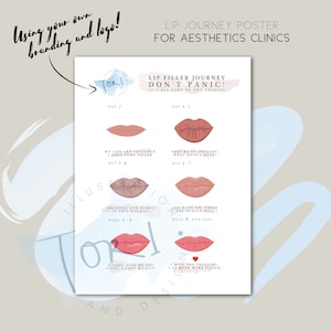 Aesthetics Clinic injector posters - Lip Filler Journey with your branding and logo