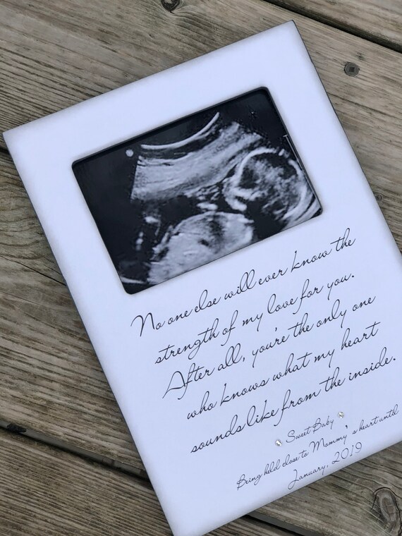 personalized ultrasound gifts