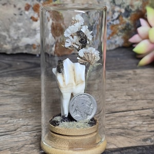 Op de afbeelding: Een unieke glazen display met een tand, gedroogde bloemen, een munt en een bij. De tand is wit met bruine vlekken. De munt is zilverkleurig. De display staat op een houten voet.