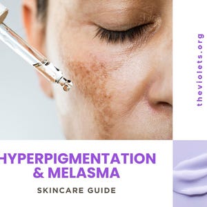 May include: A person's face with areas of hyperpigmentation and melasma. A dropper is dispensing a clear liquid. The text "HYPERPIGMENTATION & MELASMA SKINCARE GUIDE" is in purple. The website "theviolets.org" is also visible in the image.
