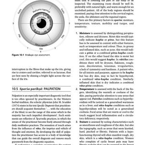 May include: A diagram of the human eye with three circles representing the three doshas: Vata, Pitta, and Kapha. The diagram is labeled with the Sanskrit terms for each dosha. The diagram is used in Ayurveda to assess the health of the eye.