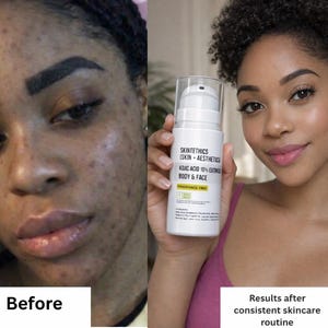 Glutathione Face Cream