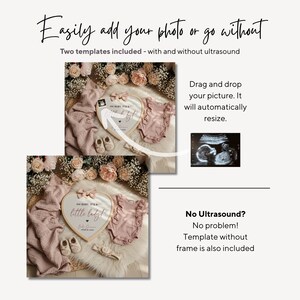 May include: A digital template for baby announcements. The image shows two templates, one with an ultrasound image and one without. The templates include a heart-shaped frame, baby clothes, and shoes. Text on the image reads "Easily add your photo or go without."