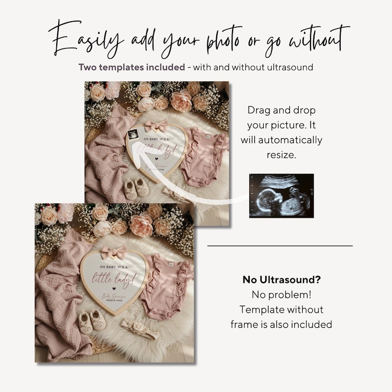 May include: A digital template for baby announcements. The image shows two templates, one with an ultrasound image and one without. The templates include a heart-shaped frame, baby clothes, and shoes. Text on the image reads "Easily add your photo or go without."