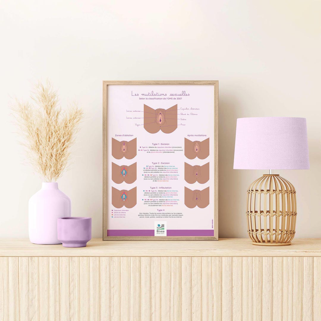 Mutilation Chart Poster Anatomical Poster | Female Genital Mutilation | Double-sided ...