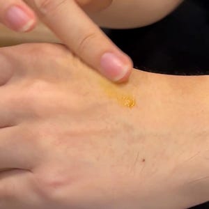 May include: A person's hand with a small amount of yellow ointment applied to the skin.