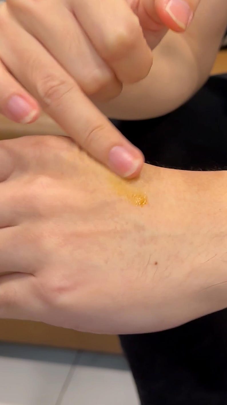 May include: A person's hand with a small amount of yellow ointment applied to the skin.