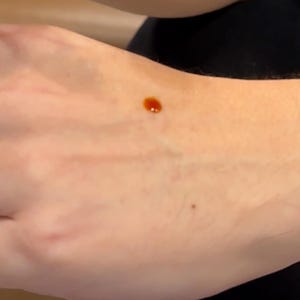 May include: A close-up of a person's hand with a small, round, orange-brown spot on the skin.