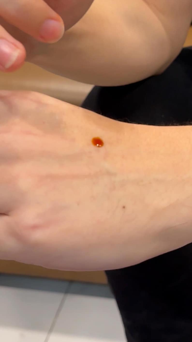 May include: A close-up of a person's hand with a small, round, orange-brown spot on the skin.