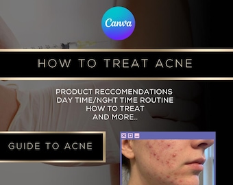 Understanding & Managing Acne-Prone Skin – Complete Guide