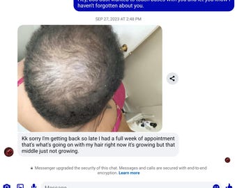 May include: Screenshot of a mobile phone conversation. The image shows a person's head with thinning hair. Text bubbles display messages, including "Hey, boo Just wanted to touch bases with you..." and "Kk sorry I'm getting back so late..."