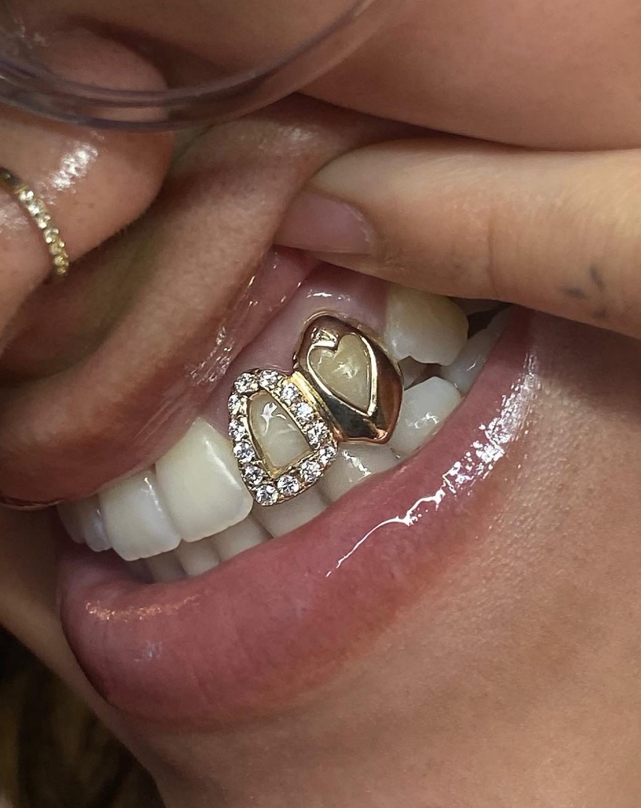 Iced Out Open Face Window + Heart Cap In Dental Gold & Sterling Silver Custom Made Grillz Any Teeth FREE Mould Kit!