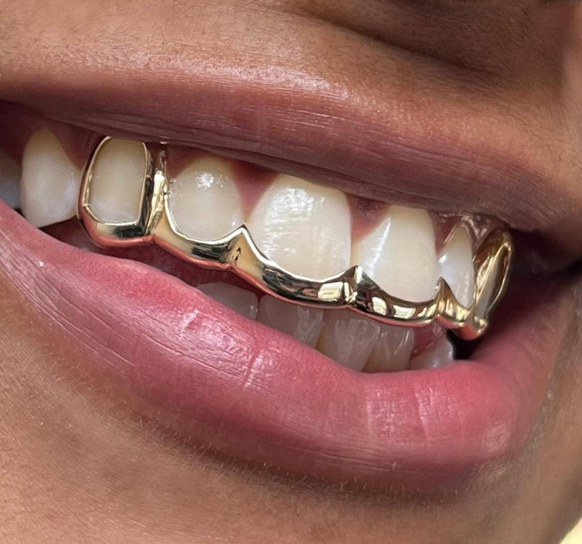 Gold Teeth Bridge - Etsy, image size:1170x1093