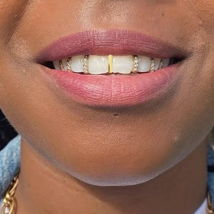 Iced Out Diamond Gap Filler Caps/ Coloured Gemstones In Sterling Silver Custom Made Grillz Any Teeth FREE Mould Kit!