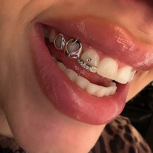 Iced Out Diamond Inlay Heart Window In Dental Gold & Sterling Silver 925 Custom Made Grillz Any Teeth FREE Mould Kit!