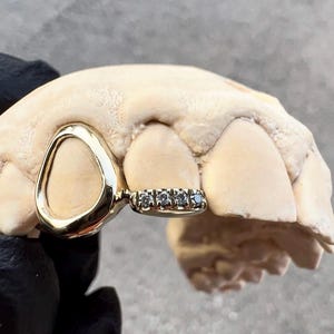 Iced Out Diamond Open Face Window Tip Cap In Dental Gold & Sterling Silver Custom Made Grillz Any Teeth FREE Mould Kit!