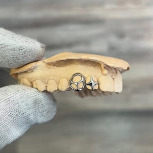Abstract Star Grillz Cap In Dental Gold & Sterling Silver Custom Made Grillz Any Teeth FREE Mould Kit!