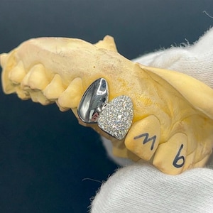 Iced Out Diamond & Plain Cap Set Sterling Silver 925 Custom Made Grillz Any Teeth FREE Mould Kit!