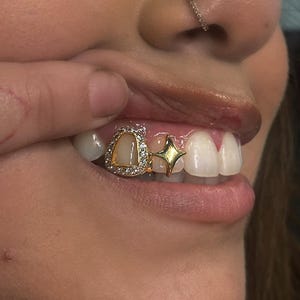 Iced Out Open Face Window + Star Cap In Dental Gold & Sterling Silver Custom Made Grillz Any Teeth FREE Mould Kit!