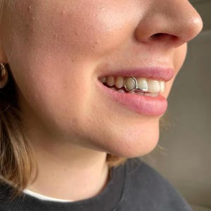 Window And Tip Cap In Dental Gold & Sterling Silver Custom Made Grillz Any Teeth FREE Mould Kit!