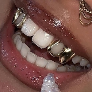 Open Face Window And Plain Gold Caps (4 Teeth)– Custom Made Gold & Silver Grillz | Personalized Grillz Sets FREE Mold Kit + Free Shipping!