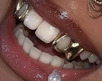 Open Face Window And Plain Gold Caps (4 Teeth)– Custom Made Gold & Silver Grillz | Personalized Grillz Sets FREE Mold Kit + Free Shipping!