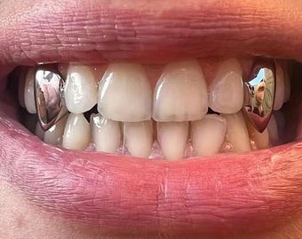 Single Sterling Silver 925 Cap Custom Made Grillz Any Teeth FREE Mould Kit!