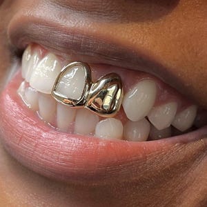 Window + Plain Cap In Dental Gold & Sterling Silver Custom Made Grillz Any Teeth FREE Shipping!