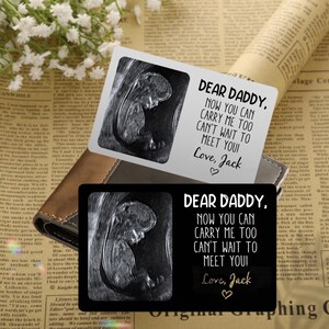 Benutzerdefinierte Metall Ultraschallbild Brieftasche Karte, perfekt für New Baby Sonogramm, Schwangerschaft Andenken, neue Vater, Baby Shower Geschenk, Vatertagsgeschenk