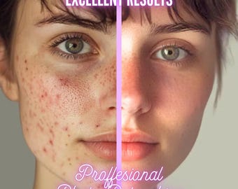 May include: Before and after photo showing the results of professional photo retouching. The left side of the image shows a person's face with acne and blemishes. The right side of the image shows the same person's face with a smooth, flawless complexion. The text "Excellent Results" is at the top of the image and the text "Professional Photo Retouching" is at the bottom of the image.