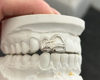 Puede incluir: Una rejilla dental de plata con un diseño de corazón. La rejilla se muestra en un molde dental blanco.