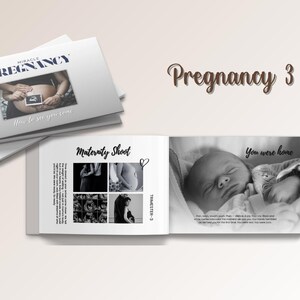 May include: A stack of white books with the title "MIRACLE PREGNANCY" and an image of a pregnant belly. The open book shows a newborn baby and the words "You were home". The theme is pregnancy and maternity.